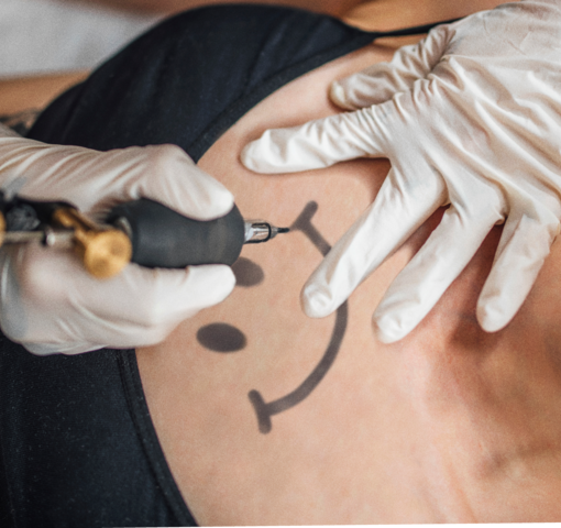 A person receiving a tattoo of the Underunderstood logo